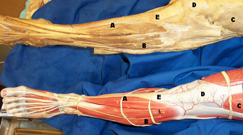 Tibialis Anterior